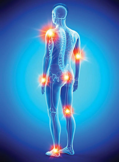 ANTI-INFLAMMATORY
