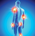 ANTI-INFLAMMATORY